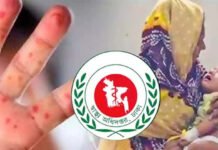 হামের উপসর্গে আরও ৩ শিশুর মৃত্যু, নতুন আক্রান্ত ৭৮৬ হামের উপসর্গে আরও ৩ শিশুর মৃত্যু, নতুন আক্রান্ত ৭৮৬