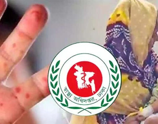 হামের উপসর্গে আরও ৩ শিশুর মৃত্যু, নতুন আক্রান্ত ৭৮৬ হামের উপসর্গে আরও ৩ শিশুর মৃত্যু, নতুন আক্রান্ত ৭৮৬